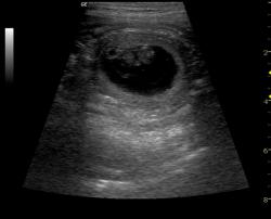 Ultraschallbild Berner Sennenhund Embryo